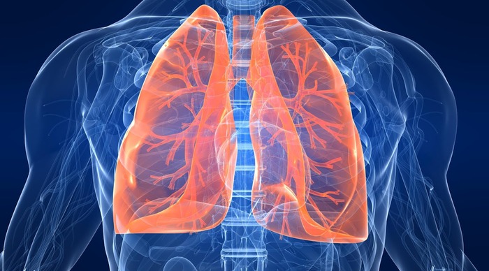 Scaled_lungstoraxgg2